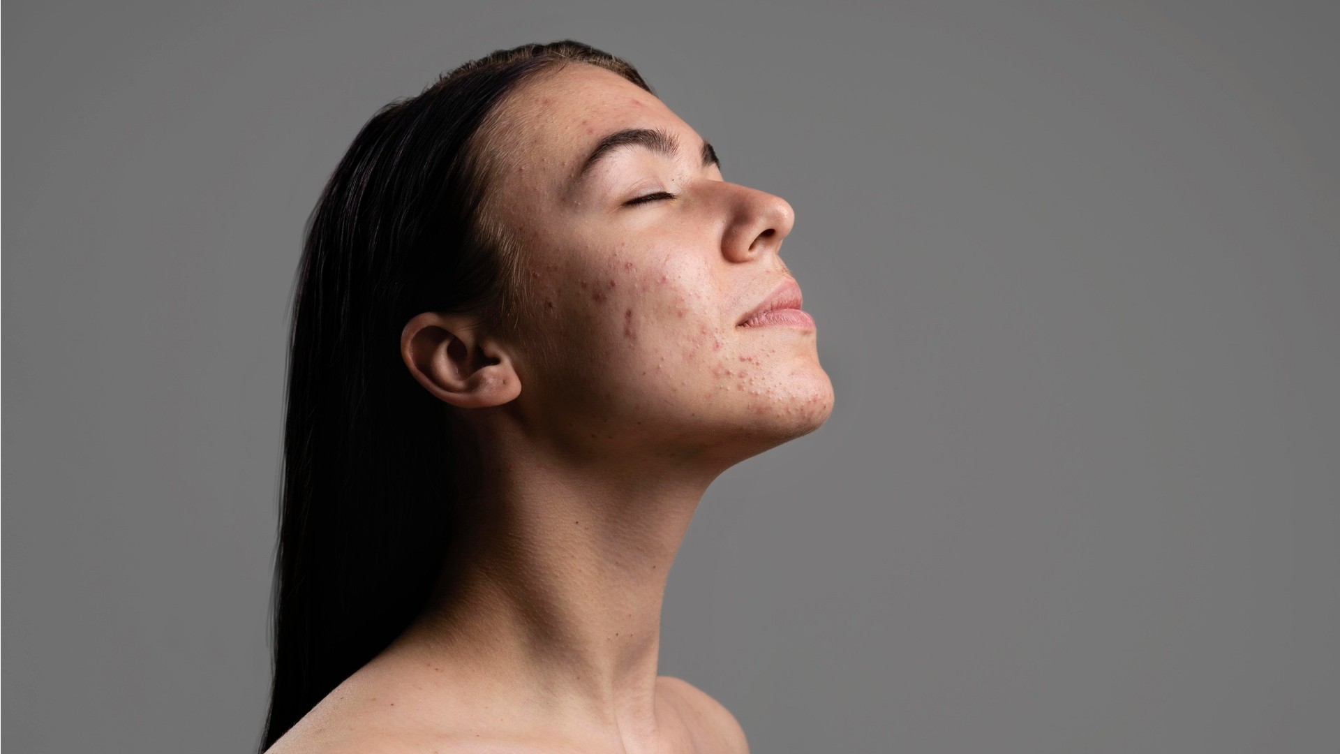 Perbedaan Antara Bintik Penuaan dengan Melanoma